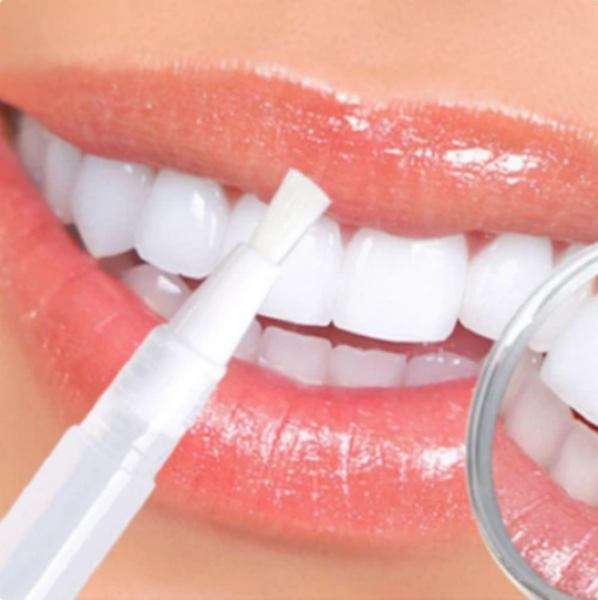  Everything to know about Teeth whitening